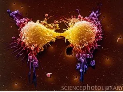 PRÓSTATA - Um Câncer em Sonetos, Poemas e Quadras